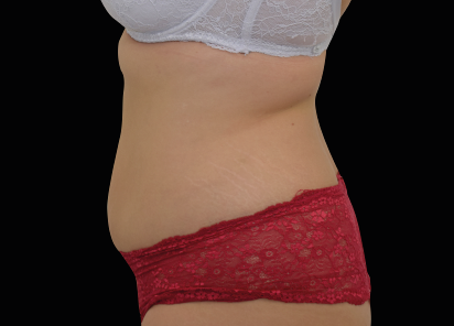 Bölgesel zayıflama sonrası