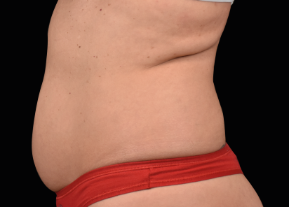 Bölgesel zayıflama öncesi